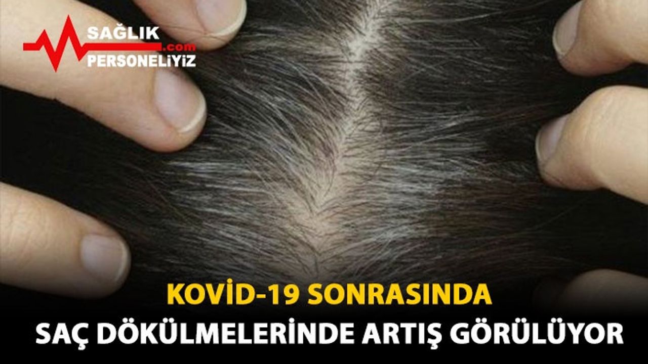 Kovid-19 Sonrasında Saç Dökülmelerinde Artış Görülüyor