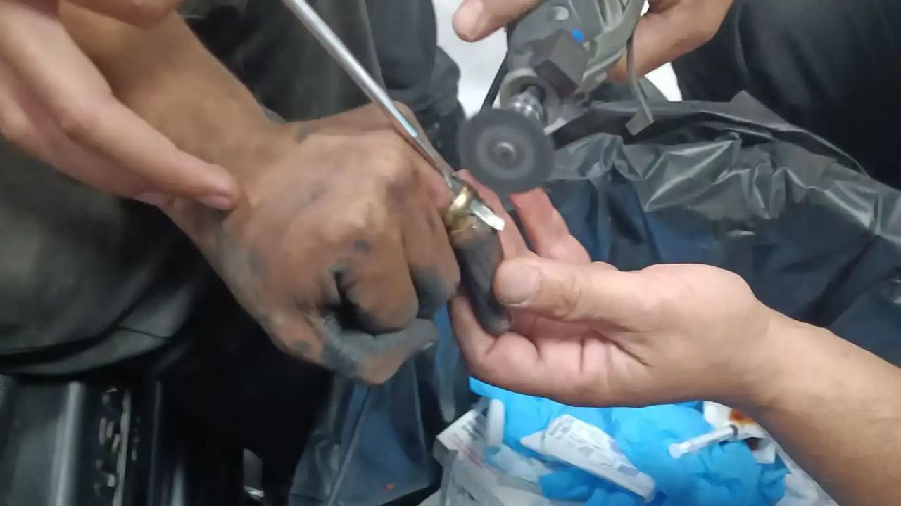 Batman Sağlıkta Skandal: Yüzük Kesme Pensi Yok!