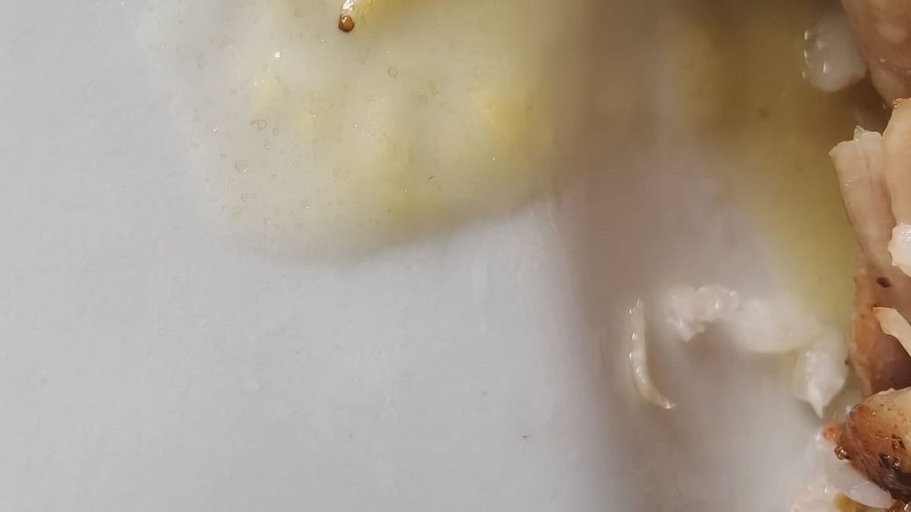 Denizli Acıpayam Devlet Hastanesi’nde Skandal: Hastane Yemeklerinden Kurt Çıktı!