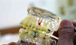 Erzincan'da Sahte Diş Hekimi 10 Kişiyi Dolandırdı