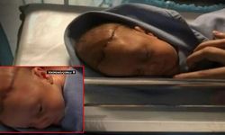 Tekirdağ'da Doğum Esnasında Dehşet! Doktor Bebeğin Başını Neşterle Kesti