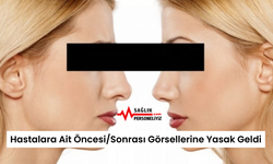 Hastalara Ait Öncesi/Sonrası Görsellerine Yasak Geldi