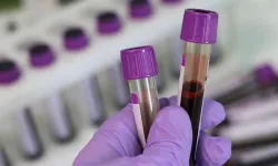 Hekimlerden Talasemi Hastalığı İçin Evlilik Öncesi Test Uyarısı