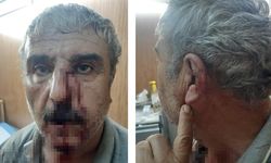 Doktor İle Emekli Öğretmenin Mesai Kavgası Karakolda Bitti