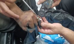 Batman Sağlıkta Skandal: Yüzük Kesme Pensi Yok!