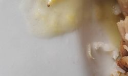 Denizli Acıpayam Devlet Hastanesi’nde Skandal: Hastane Yemeklerinden Kurt Çıktı!