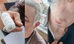 Doktora Şiddet İddiasına Valilik Soruşturma Başlattı