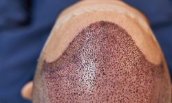 Trabzon’da Saç Ekimi Sırasında Fenalaşan Temel Altuntaş Hayatını Kaybetti