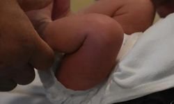 İstanbul’da Sünnet Sonrası 27 Günlük Bebek Hayatını Kaybetti