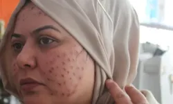 Gençlik Aşısı Skandalı İddiası: Doktor Hakkında Soruşturma İzni