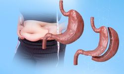 Mide Küçültme Ameliyatı Ölümü Davasında 4 Sağlıkçı Tahliye