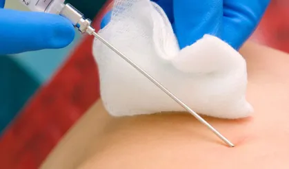 Mersin’de Biyopsi Sonrası Ölüm: İhmal İddiası Gündemde