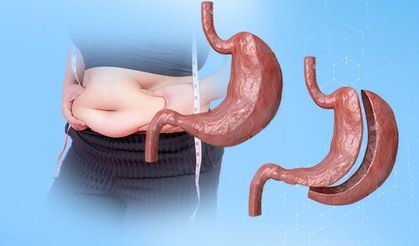 Mide Küçültme Ameliyatı Ölümü Davasında 4 Sağlıkçı Tahliye