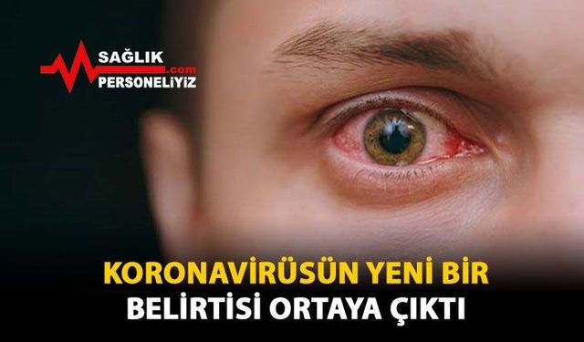 Koronavirüsün Yeni Bir Belirtisi Ortaya Çıktı