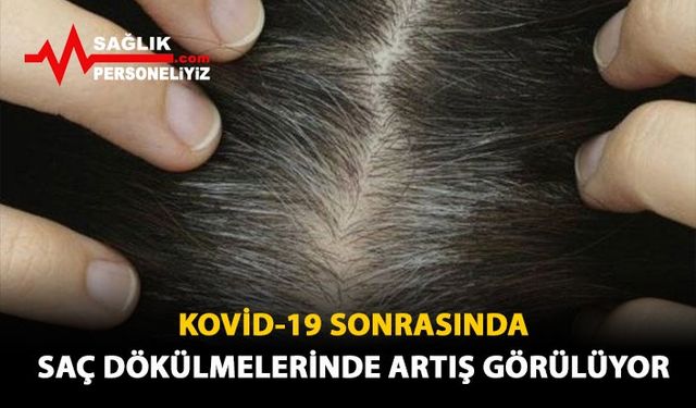 Kovid-19 Sonrasında Saç Dökülmelerinde Artış Görülüyor