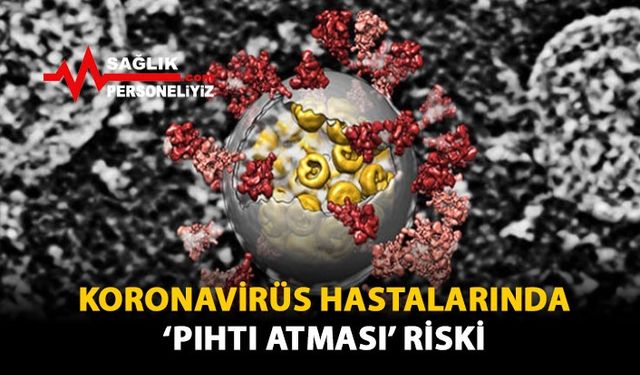 Koronavirüs Hastalarında 'Pıhtı Atması' Riski