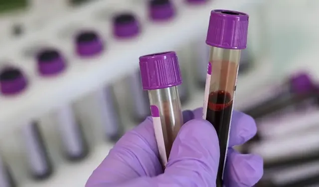 Hekimlerden Talasemi Hastalığı İçin Evlilik Öncesi Test Uyarısı
