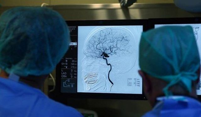 'İnme ve Felçten Dolayı Her Yıl 45 Bin İnsan Ölüyor'