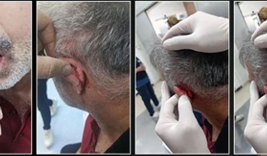 Gaziantep’te Hastane Personeline Röntgen Odasında Saldırı