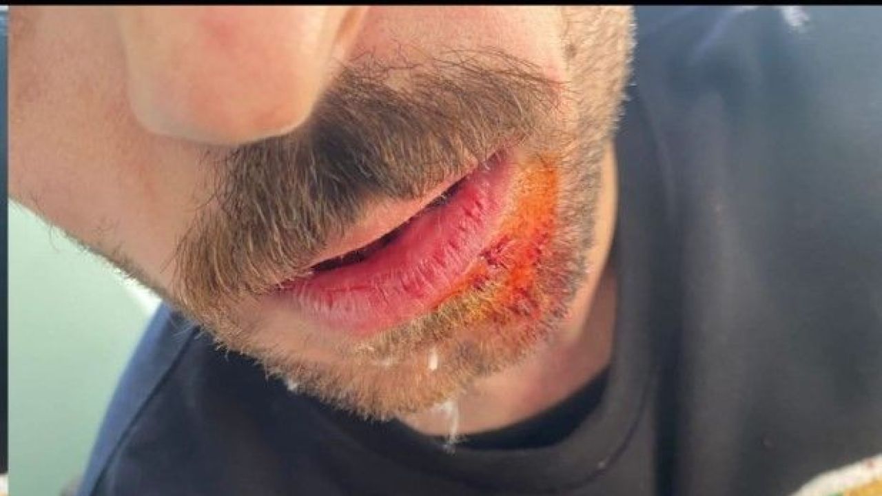 Akcakalede Saglikta Siddet Iki Saglik Calisani Darbedildi